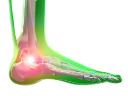 Joint pains