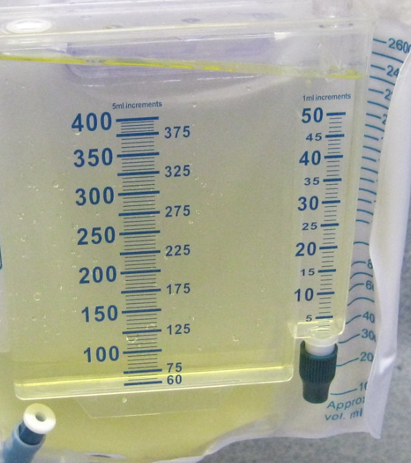 Homeopathy treatment for urinary complaints