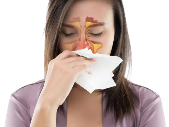 Homepathy Treatment for Sinusitis