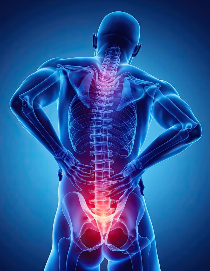 Homeopathy Treatment for Cervical & Lumbar Spondylitis