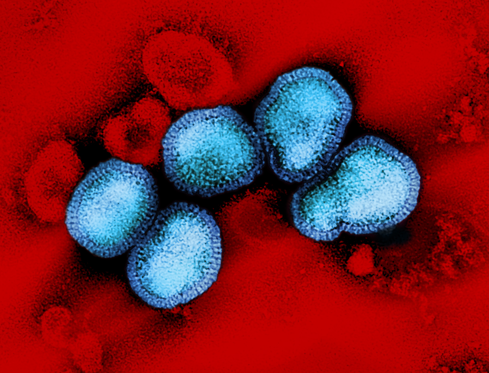 Homeopathy Treatment for Influenza A