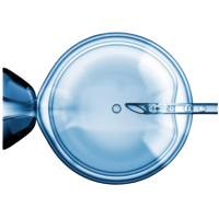 Infertility treatment