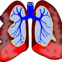 Homepathy Treatment for Respiratory Illnesses