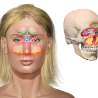 Homeopathy Treatment for Sinusitis
